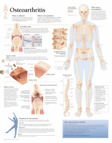 Osteoarthritis | Scientific Publishing