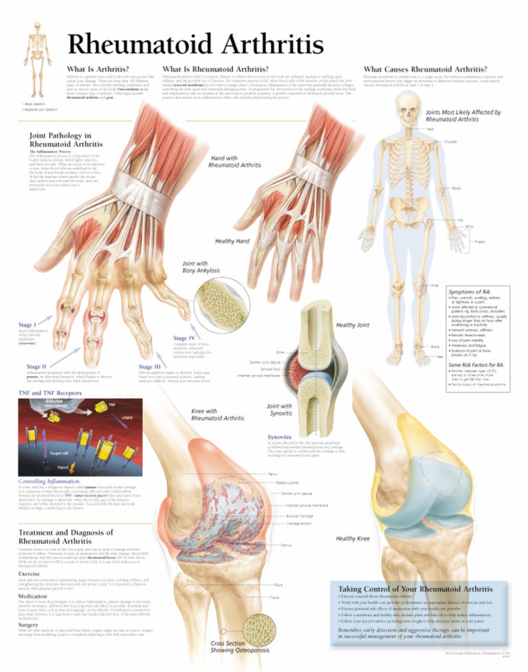 rheumatoid-arthritis-scientific-publishing