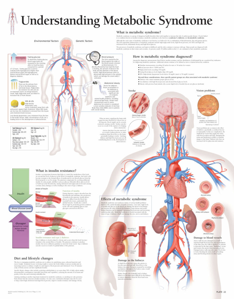 understanding-metabolic-syndrome-scientific-publishing